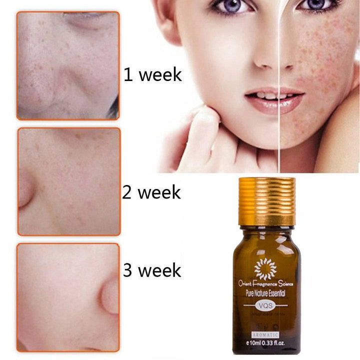 Dredge Meridian Skin Care Natural Pure Removal Acne Stretch Marks Scar Removal Essence oil - Mamofa Global Store