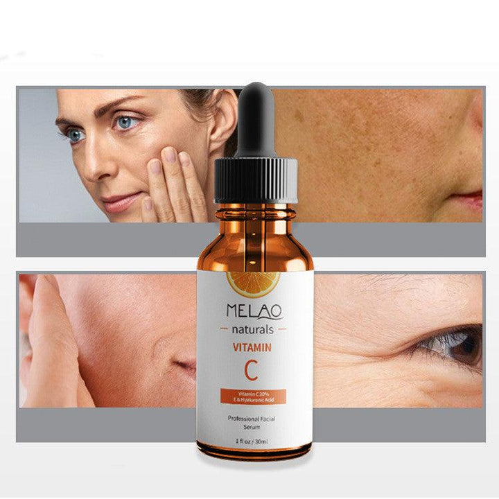 Anti-wrinkle Vitamin C Serum - Mamofa Global Store