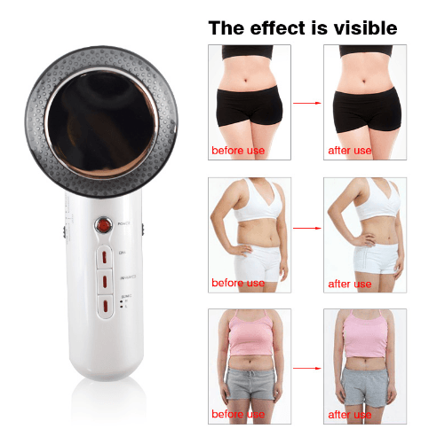 Beauty Care Slimming Device Handheld Ultrasound Body Fat Remove Massager - Mamofa Global Store