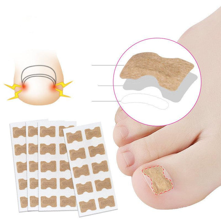 Glue-free orthopaedic nail fixation device - Mamofa Global Store